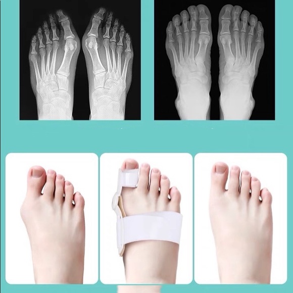 Foot orthotics - Picture 4 of 5